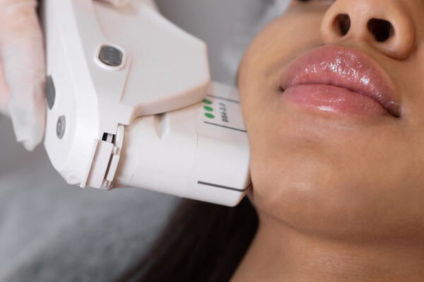 7D Hifu facial treatment