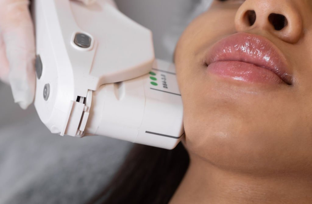 7D Hifu facial treatment