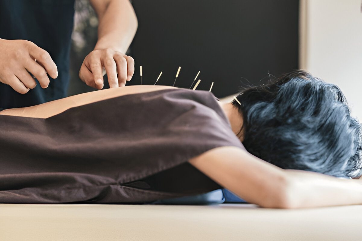 Acupuncture Clinic