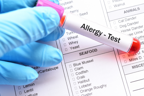 Allergy test london
