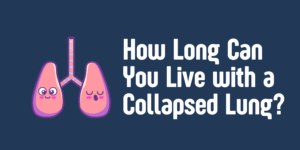 How Long Can You Live with a Collapsed Lung?