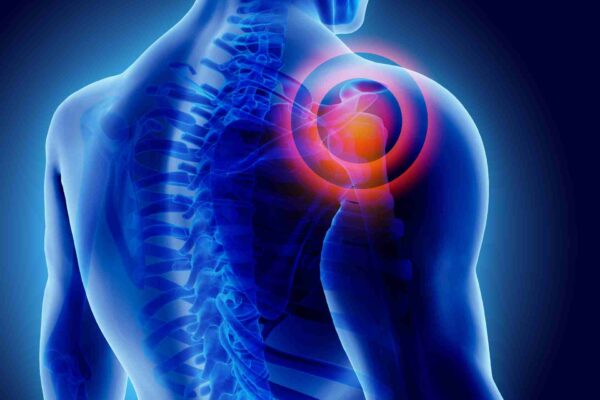 chronic shoulder joint pain relief
