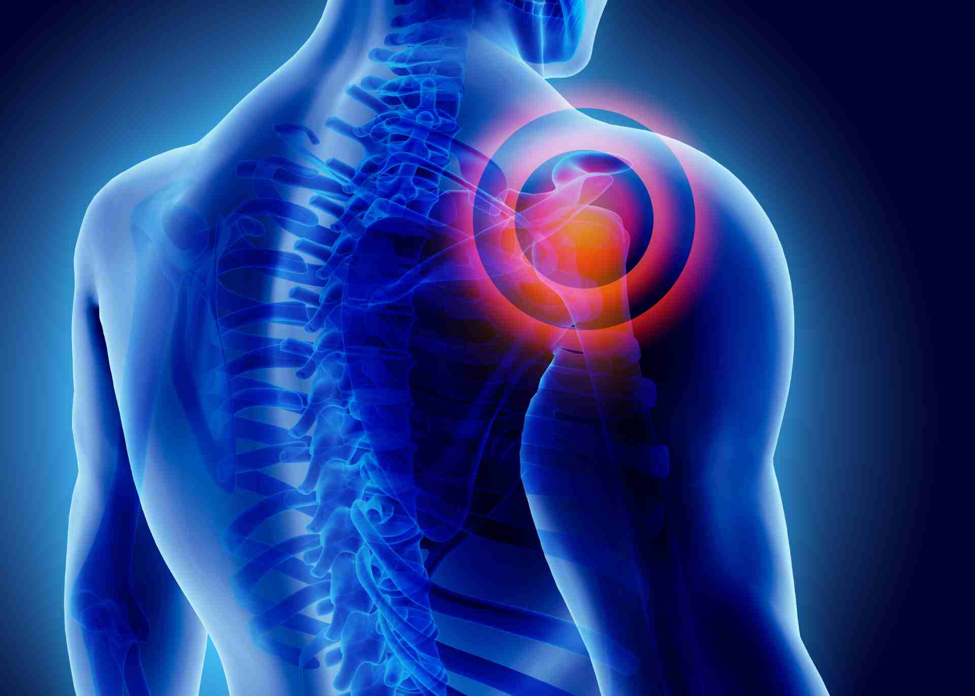 chronic shoulder joint pain relief
