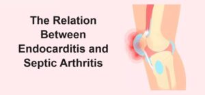 Our heart is the most important organ in our entire body. It facilitates the circulation of blood across all vital organs so as to ensure that we keep living a healthy life without major complications. This article deals with Endocarditis. To learn about this heart disease, refer to the information given below. What is Endocarditis? Endocarditis is an inflammatory heart condition. It happens when the inner lining of the heart gets inflamed. The inner lining is medically known as the Endocardium; thus, inflammation of the Endocardium is Endocarditis. This inflammation is usually caused by bacterial growth within the heart. This heart-related condition isn’t common as it doesn’t usually happen to a healthy heart. Symptoms The symptoms of Endocarditis are often mild and not severe at all. Severe symptoms in this condition develop slowly and often resemble those from various other medical conditions. Because this condition has symptoms also common in other diseases, many cases of Endocarditis might go undiagnosed in the early stages. Endocarditis causes the same physical conditions as typical of the flu and pneumonia. Still, the following are some of the physical changes in the case of Endocarditis. ● The colour of your skin can turn pale; ● You might also experience fever and chills; ● Night sweats are also common; ● Muscle and joint inflammation and thus the concomitant pain and mobility issues occur; ● You might also feel like vomiting with a decrease in your appetite. ● Cough and breathing difficulties are other symptoms. However, all these symptoms don’t surface the next day after you have got Endocarditis. As the infection and inflammation of the inner lining of the heart grows, you become more and more ill in this manner. Causes It has already been mentioned that this condition is caused by the infestation of bacteria inside the lining of the heart. So, the primary cause of Endocarditis is bacteria entering inside your body and entering inside your heart through the bloodstream. There are several reasons as to how bacteria can enter your bloodstream finally ending up in your heart and joints. If you have taken something inside your body already contaminated, this is one way but not all. Falling down and sustaining bruises and scratches on contaminated surfaces, grounds and floors is another way of getting bacteria in. Dealing with someone who is already infected can also facilitate the communication of the infection from one person to another. If you don’t take good care of your oral hygiene or you have gum diseases, this could also become the reason for Endocarditis long run. STDs also cause such infections inside the heart cavity if contracted. Treatments The treatment of Endocarditis mainly depends on antibiotics and surgery. The doctor can put the affected person on antibiotics for a period until the infection and inflammation is completely gone. Endocarditis in its mild stage isn’t serious enough to be fatal. Take your antibiotics on time as prescribed and you will be healthy again to lead a normal life. However, in severe cases, if it is required, a doctor will perform surgical interventions to correct the situation. In this particular surgical case, you might have to be hospitalised for rehabilitation and normal recovery. Post-surgery medical attention is crucial if you want to keep the potential complications at bay. Can Endocarditis cause joint problems? Yes; if the infectious conditions travel all the way from your heart to joints via the bloodstream, it might cause joint problems. This basically happens because your body has joints that contain synovial fluid. This fluid is there to lubricate the joints like your knees or hips. By the presence of such fluid contents, frictional trauma is reduced and as a result, you can walk and mobilise the joint without too much wear and tear. So, bacteria can travel via the bloodstream to any part of the body. If they reach the joint cavity, it can lead to joint inflammation commonly known as Septic Arthritis. What is Septic Arthritis? Septic arthritis is a joint-related inflammation caused by germs. In this condition, joint inflammation gives rise to pain, redness, tenderness and swelling, impacting the joint mobility severely. Germs, bacteria or any other microorganism can enter a joint either through an internal body infection like Endocarditis or directly through any other external events like using a contaminated injection, if a street dog has bitten you etc. If you are looking for the best surgeon well-trained in performing arthroplasty, meet with the best surgeon by visiting the following link: best surgeon for hip replacement surgery. How to prevent Endocarditis The following are effective ways to keep the risk of this heart problem away from you. ● Take care of your oral health; ● Take antibiotics if you have infections; ● Stay away from body piercing; ● Don’t get tattoos done on your skin as it might lead to the invasion of bacteria inside you; ● Practising good hygiene is also crucial; and, ● Don’t use dirty public toilets; All these points are preventative measures for Endocarditis. General tips on keeping your body healthy Furthermore, if you take care of your health, you are less prone to getting Endocarditis. Here are some of the health tips. Adequate Sleep: A good night's sleep is the remedy to many health problems. Prolonged sleep deficiency is linked to compromised immunity and thus various complications. So, sleep for at least 7-8 hours if you are an adult. Strong Immunity: If your immunity isn’t strong, take measures to work on that. You can consume medicines or foods that are intended to help boost immunity. Balanced Diet: After sleep, a balanced diet assumes importance. So, eat meals rich in all forms of macro and micronutrients. Ensure calcium, vitamin D, protein, antioxidants, and all your body needs to function properly. Exercise: This lifestyle element helps by building your strength, flexibility and balance. Exercise regularly and it will help increase your stamina to fight off many infections that might need medical attention otherwise. Timely Dental Check-Ups: If you have dental problems, go for check-ups in time or it will exacerbate the oral conditions. Poor oral health is often associated with increasing the risk of Endocarditis. Timely Management of Infections: If any part of your body gets infected because of some bacterial invasion inside the body, book your appointment with a doctor to deal with it before it gets worse. Conclusion Endocarditis is not a serious disease that can be fatal. However, it is an inflammatory condition that might go unchecked or unnoticed due to mild symptoms and similarities with other health problems in the early stages. Thus, its diagnosis and effective treatment are crucial. In its aggravated form, this condition can also lead to Septic Arthritis causing joint pain and mobility issues. If you have joint problems like chronic and severe knee pain or hip pain and are looking for the best doctor for consultation, refer to the following link: orthopedic doctor in West Delhi.