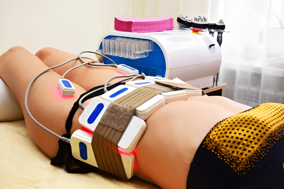 laser body sculpting