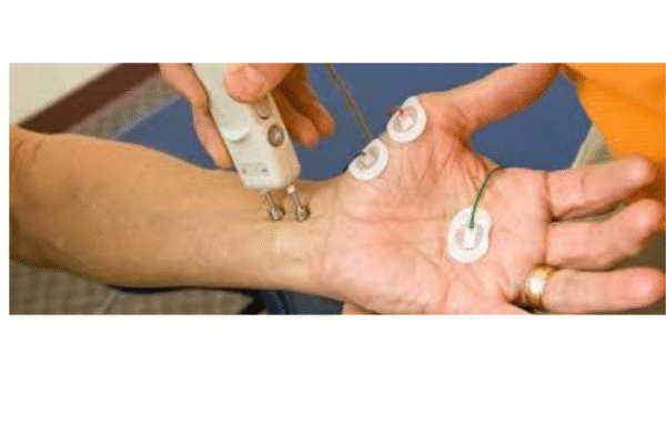 NCV Test Near Me: A Complete Guide to Nerve Conduction Studies