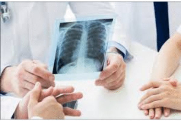 X-Ray OPG Scan in Bengaluru X-Ray OPG Scan in Bengaluru