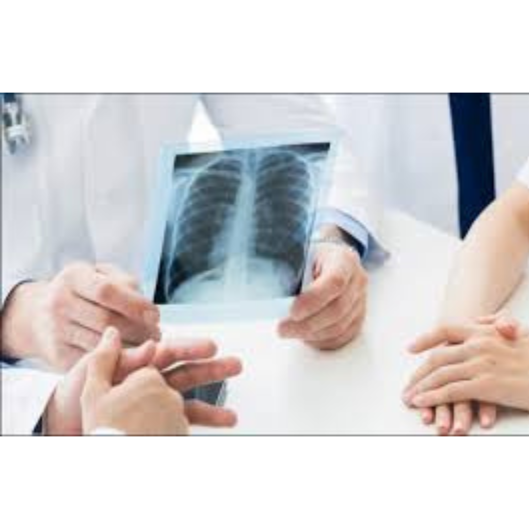 X-Ray OPG Scan in Bengaluru