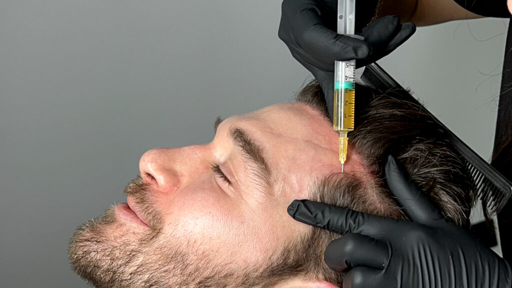 Is PRP Hair Treatment Worth the Investment?