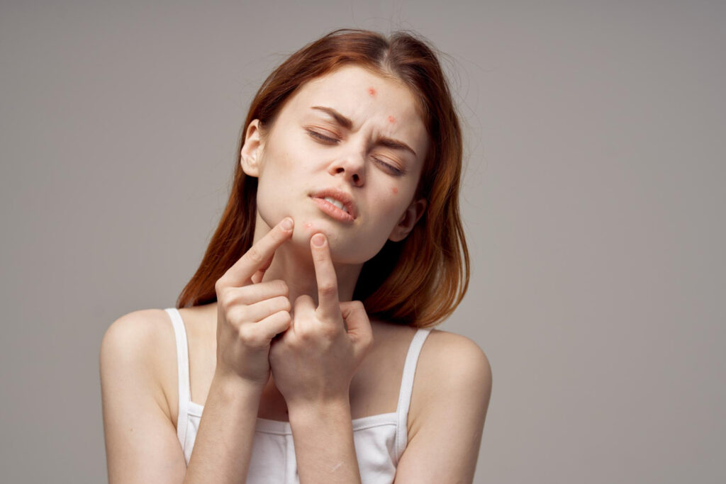 Acne Treatment In Dubai