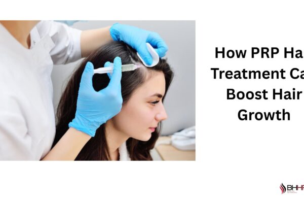 prp hair treatment